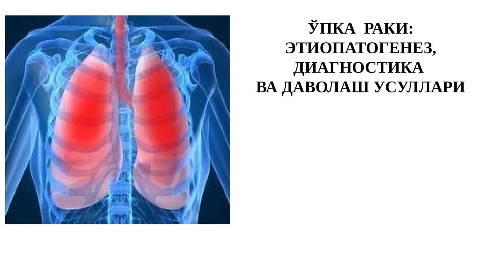 ЎПКА РАКИ