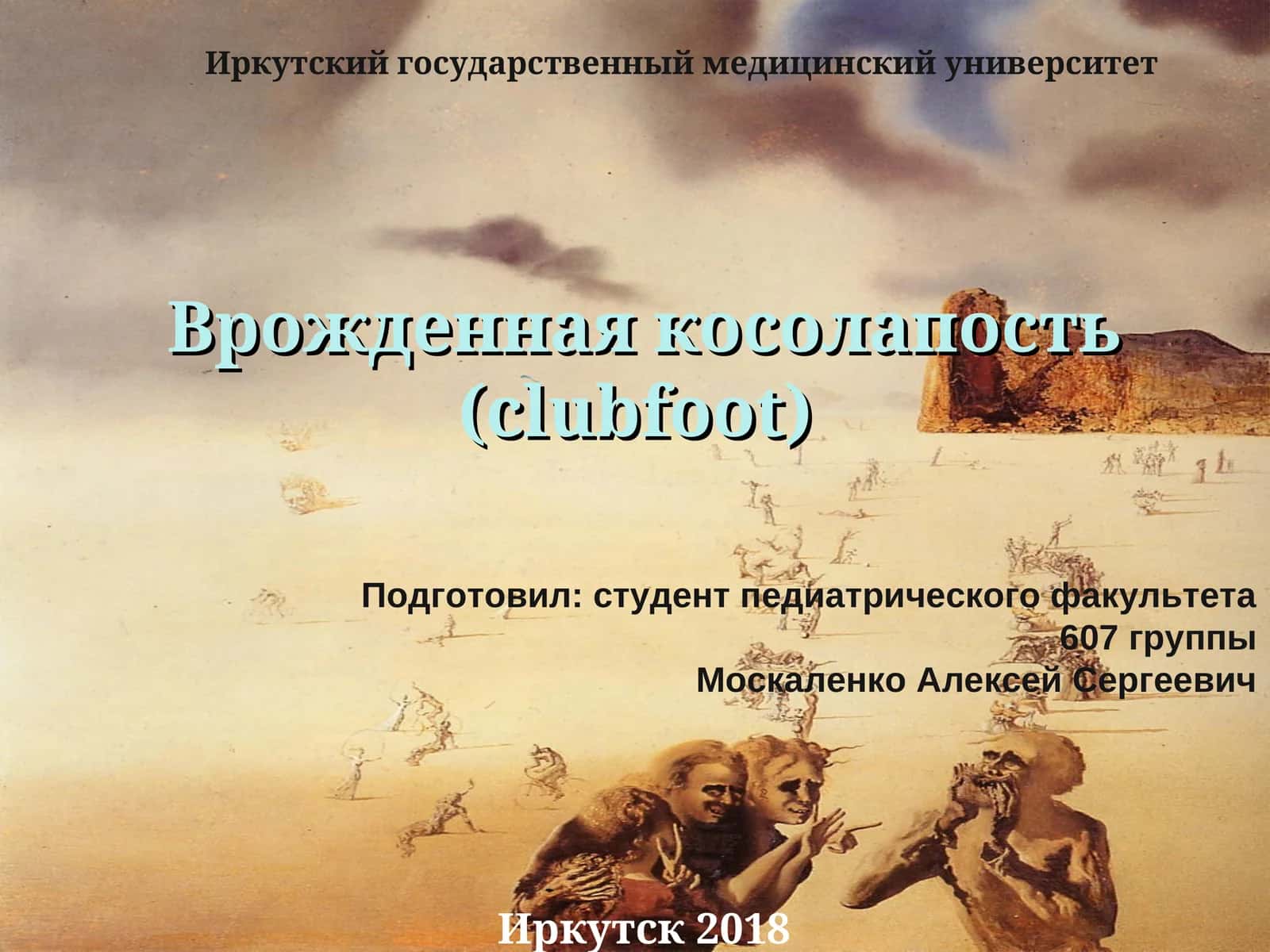 Врожденная косолапость (clubfoot)