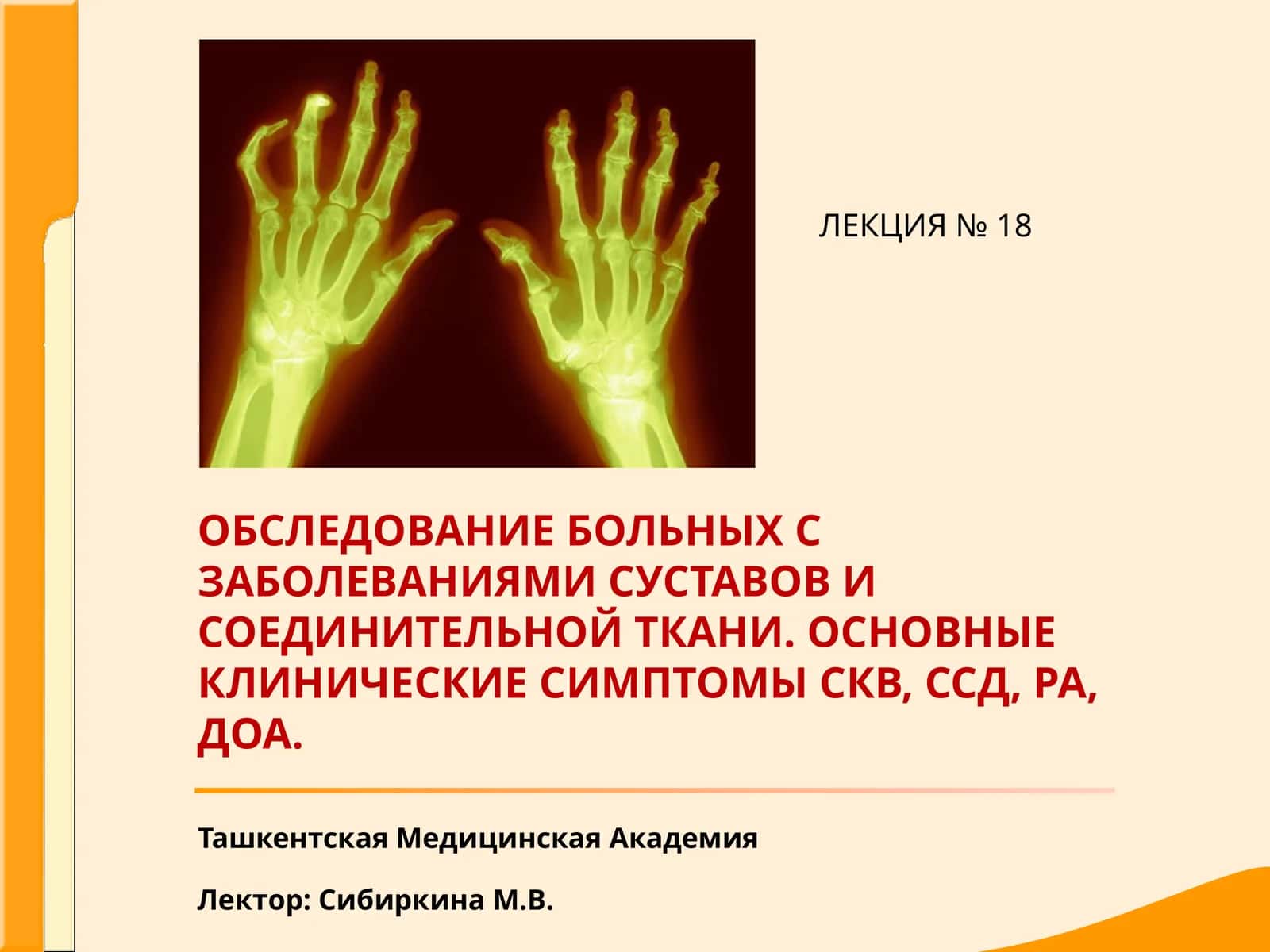 Диффузные заболевания соединительной ткани