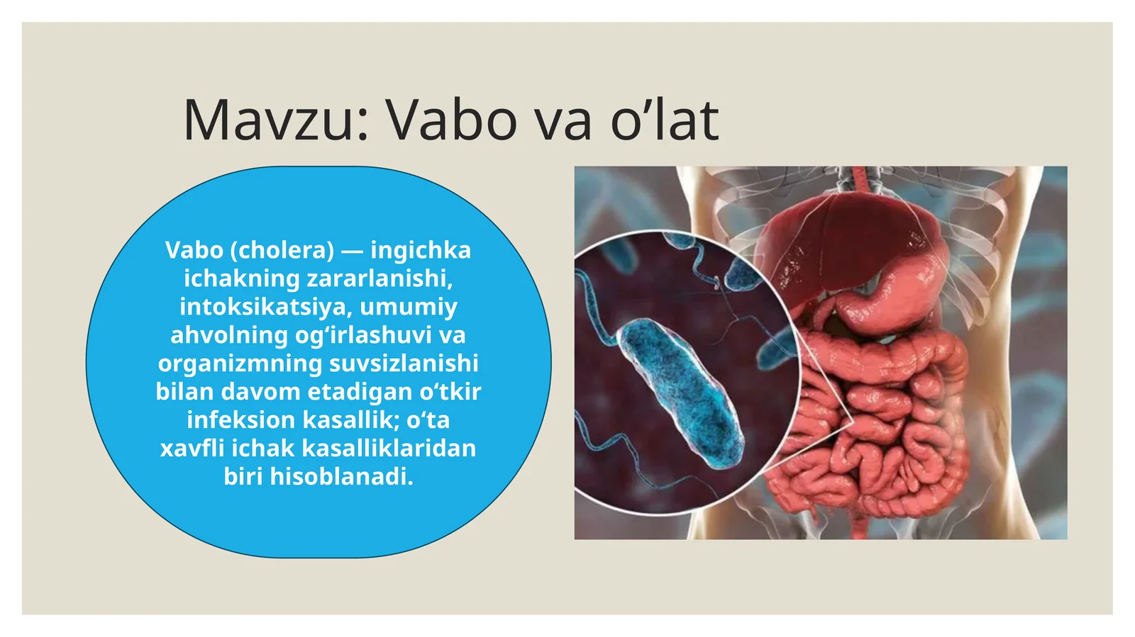 Vabo (cholera)