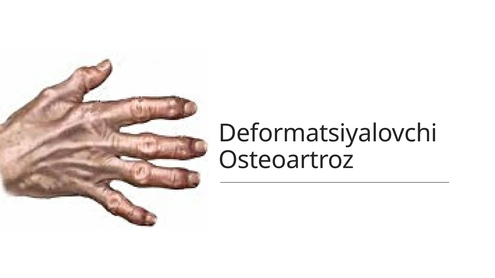 Deformatsiyalovchi Osteoartroz
