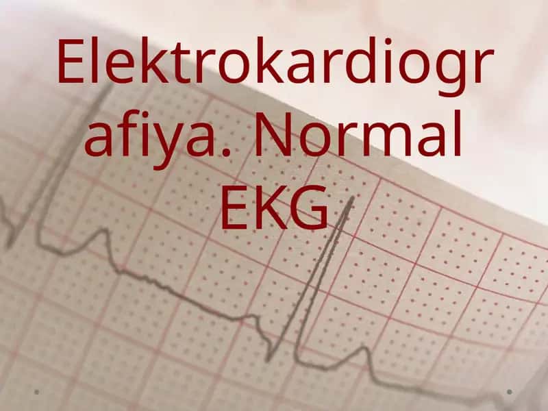 EKG