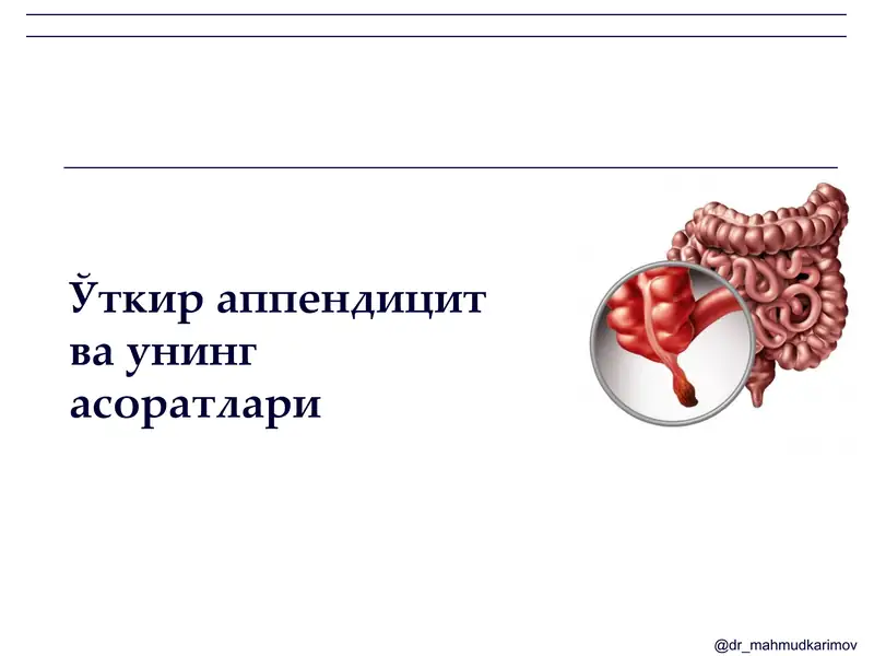 Ўткир аппендицит ва унинг асоратлари