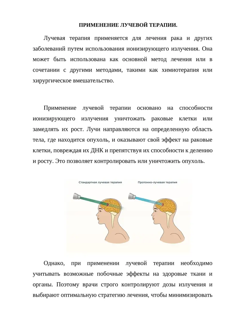 ПРИМЕНЕНИЕ ЛУЧЕВОЙ ТЕРАПИИ