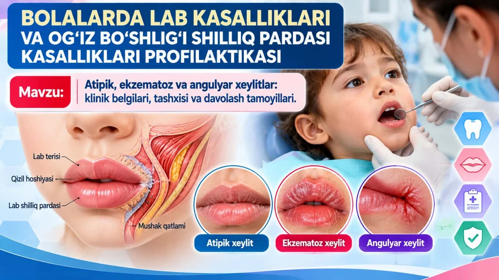 Bolalarda lab kasalliklari Atipik, Ekzematoz va Angulyar xeylitlar Klinik belgilar, tashxis, davolash va profilaktika.pptx