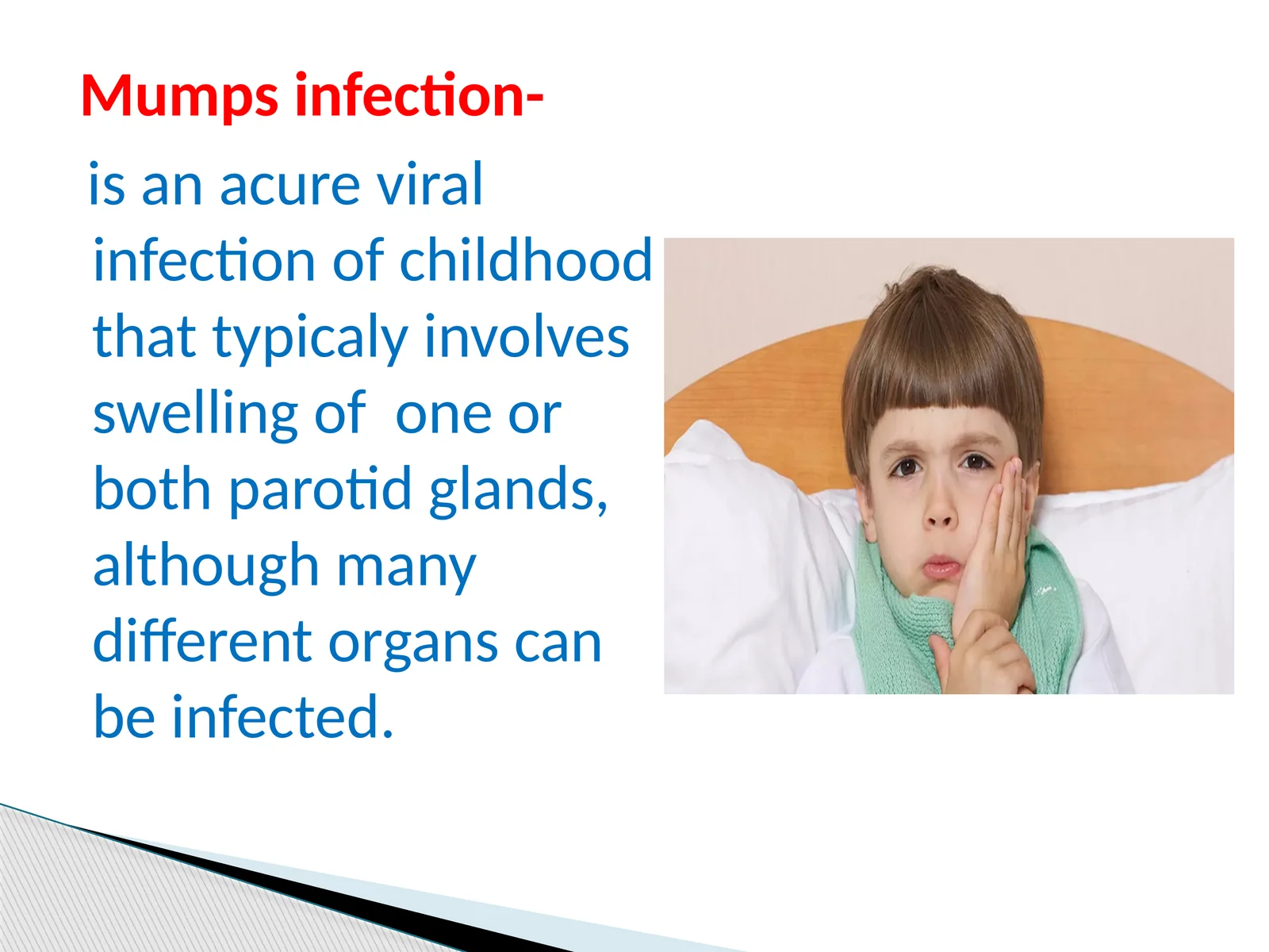 Mumps infection