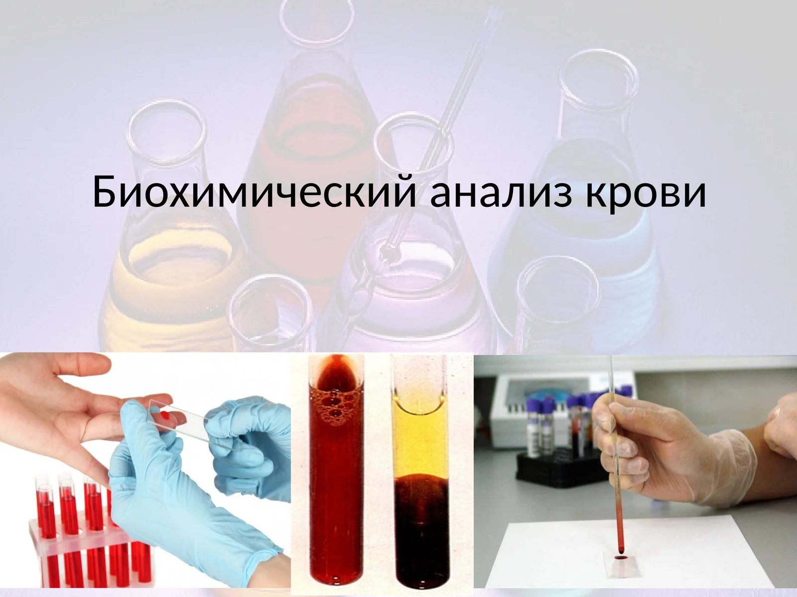 Биохимический анализ крови