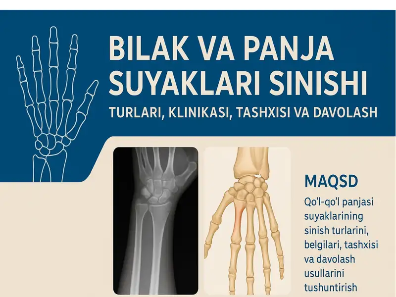 Bilak va panja suyaklari sinishi