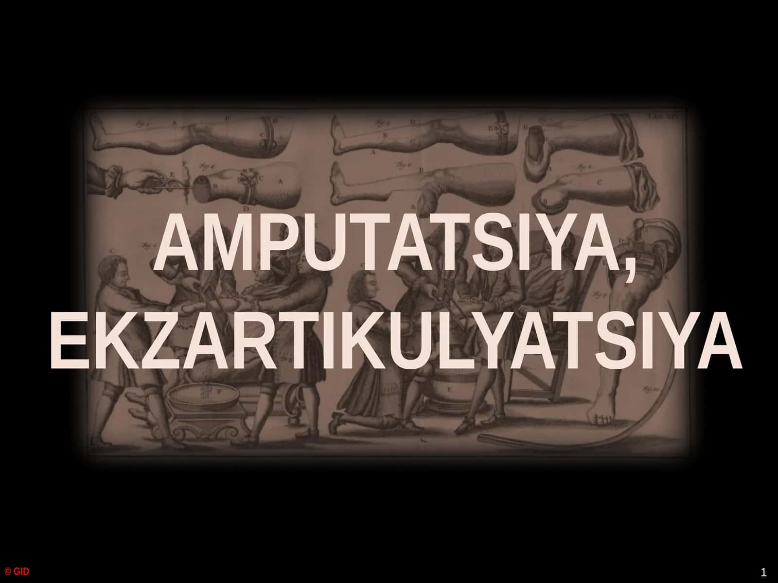 Amputatsiya, Ekzartikulyatsiya