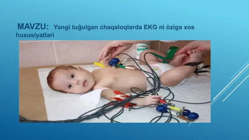Elektrokardiogramma (EKG)
