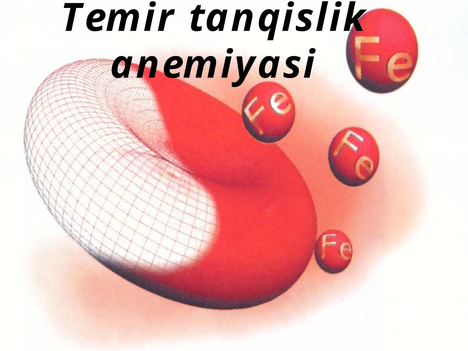 Temir tanqislik anemiyasi