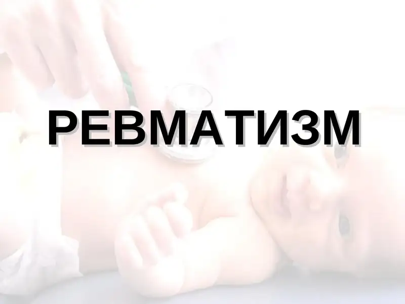 Ревматизм