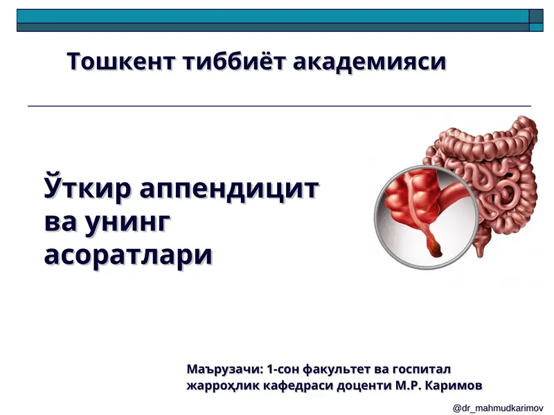 Ўткир аппендицит ва унинг асоратлари