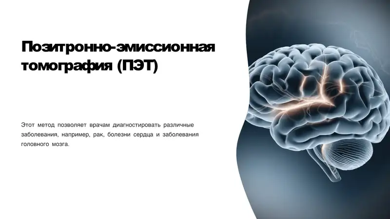 Позитронно-эмиссионная томография (ПЭТ)
