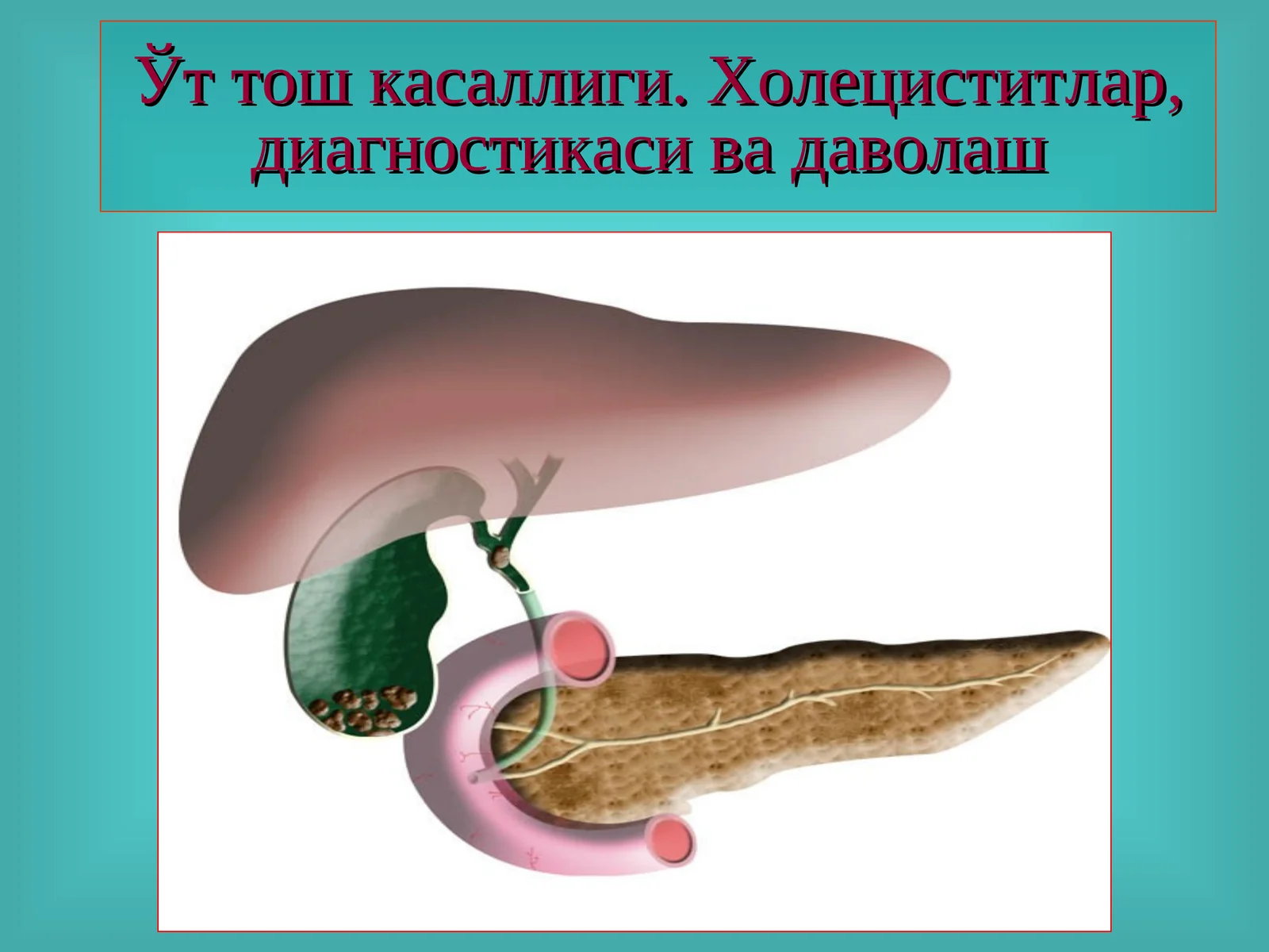 Ўт тош касаллиги.Холециститлар, диагностикаси ва даволаш