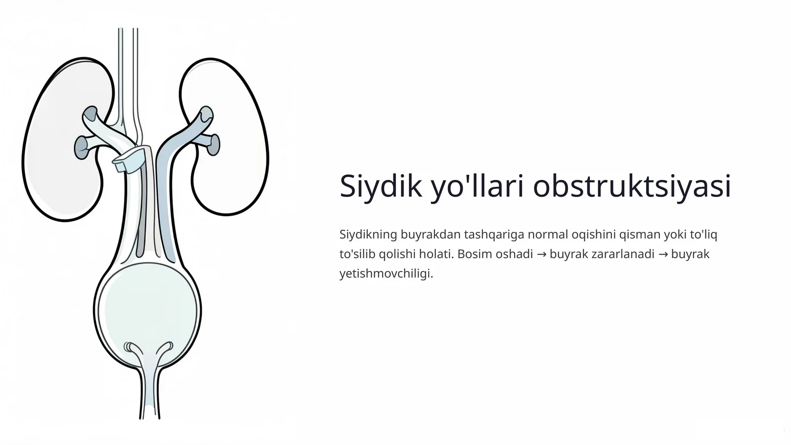 Siydik yo'llari obstruktsiyasi