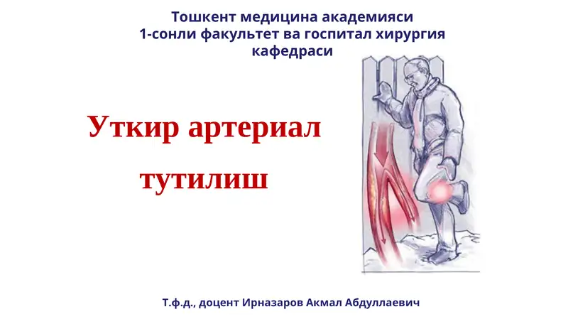Уткир артериал тутилиш