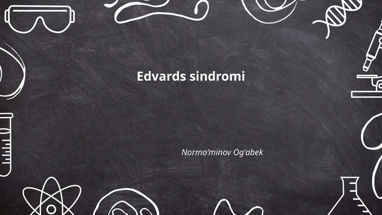 Edvards sindromi