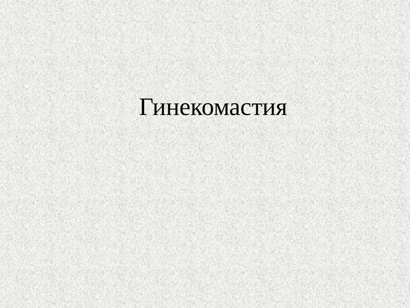 Гинекомастия