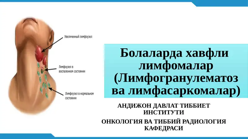 Болаларда хавфлилимфомалар(Лимфогранулематозвалимфасаркомалар)