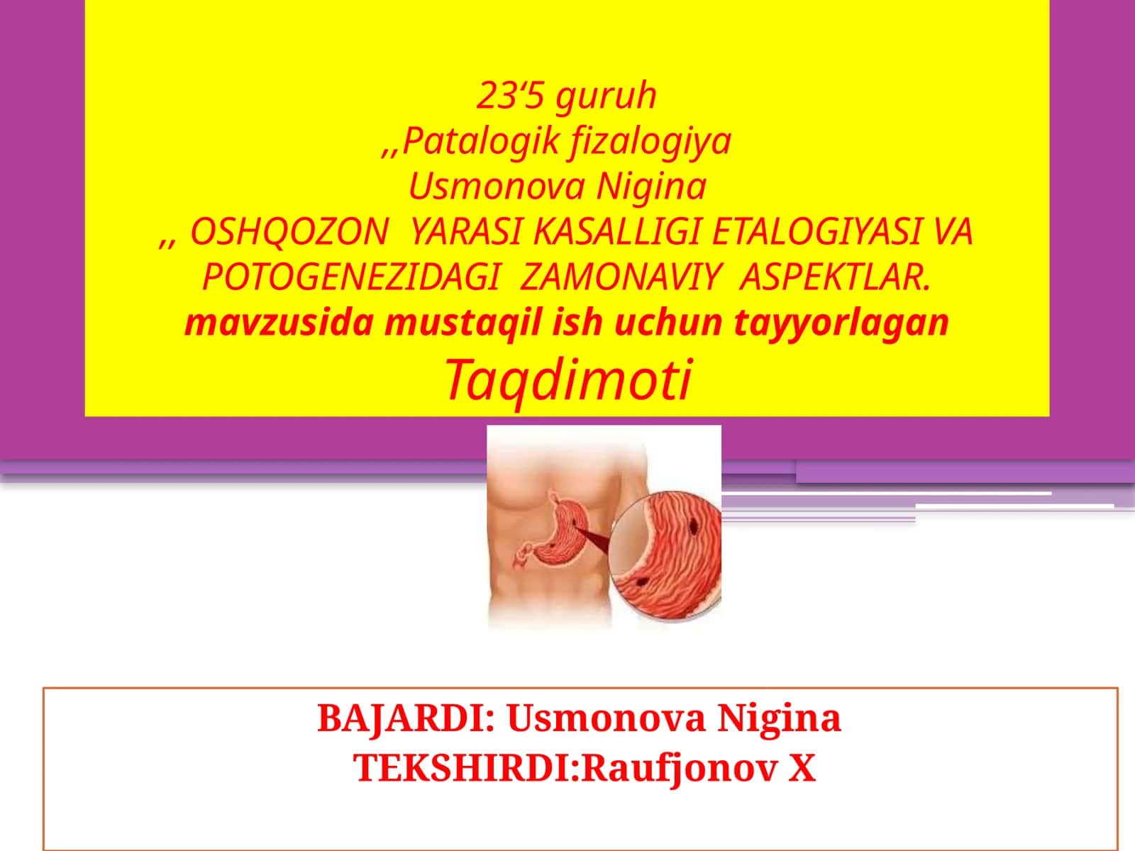 OSHQOZON YARASI KASALLIGI ETILOGIYASI VA POTOGENEZIDAGI ZAMONAVIY ASPEKTLAR