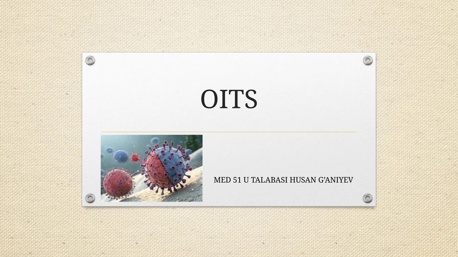 OITS