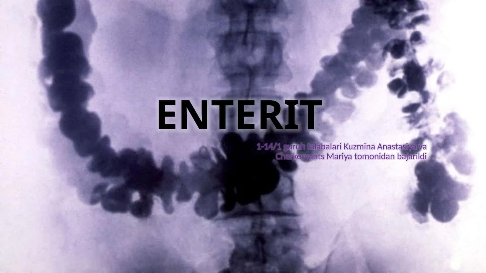 Enterit ingichka ichak yallig'lanishi (1-variant)