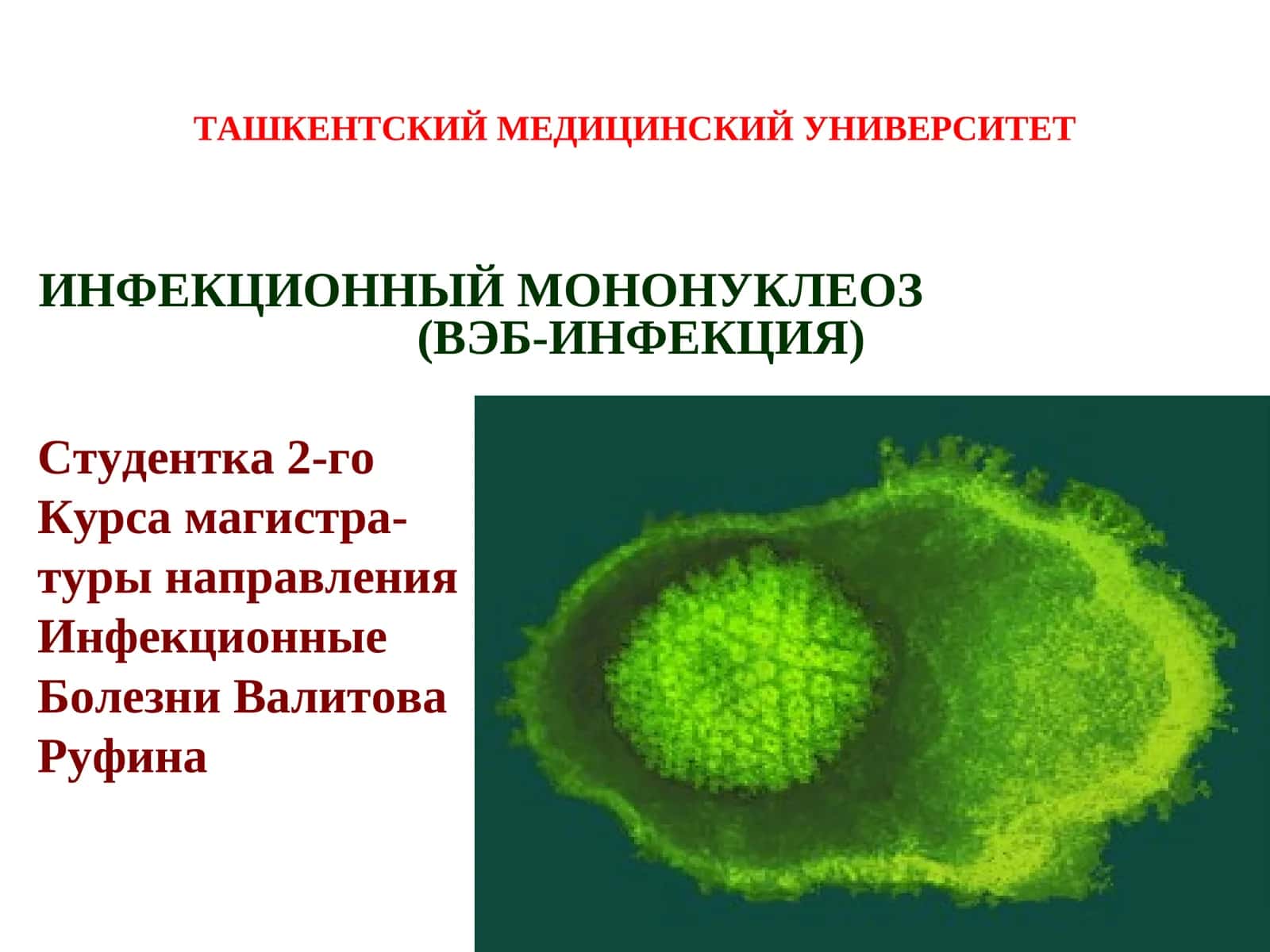 ИНФЕКЦИОННЫЙ МОНОНУКЛЕОЗ (ВЭБ-ИНФЕКЦИЯ)