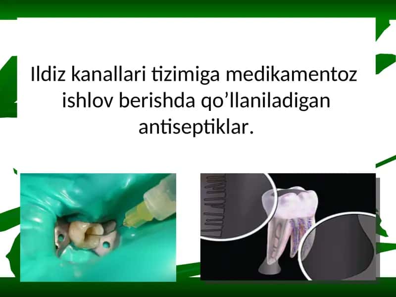 Natriy gipoxlorit (NaOCl)