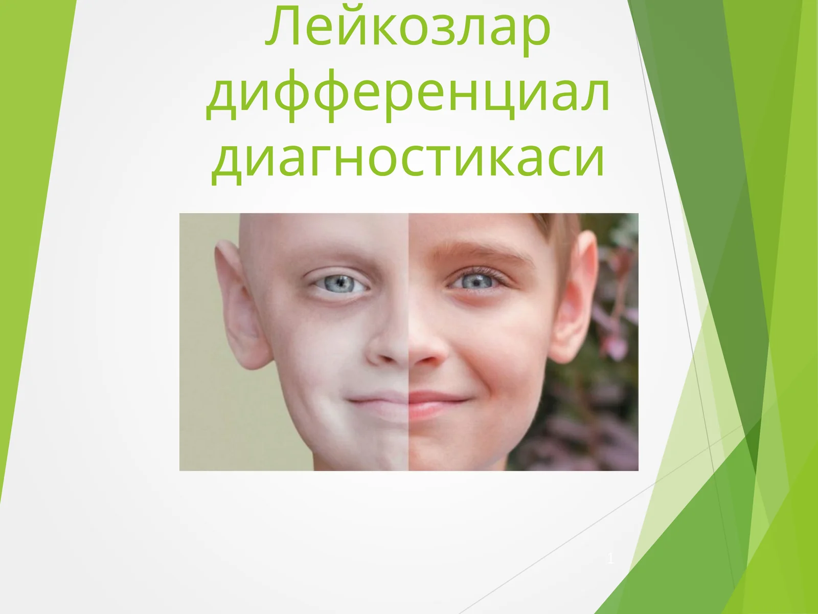Лейкозлар дифференциал диагностикаси