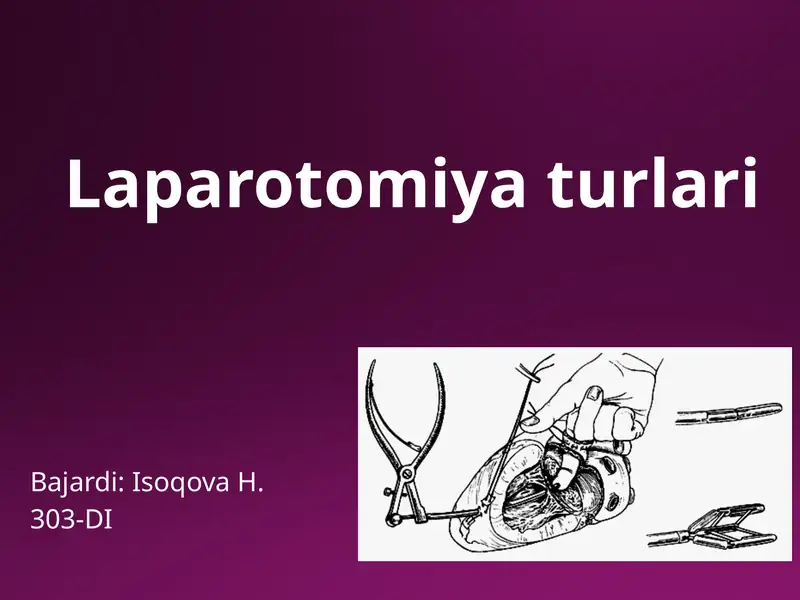 Laparotomiyaturlari