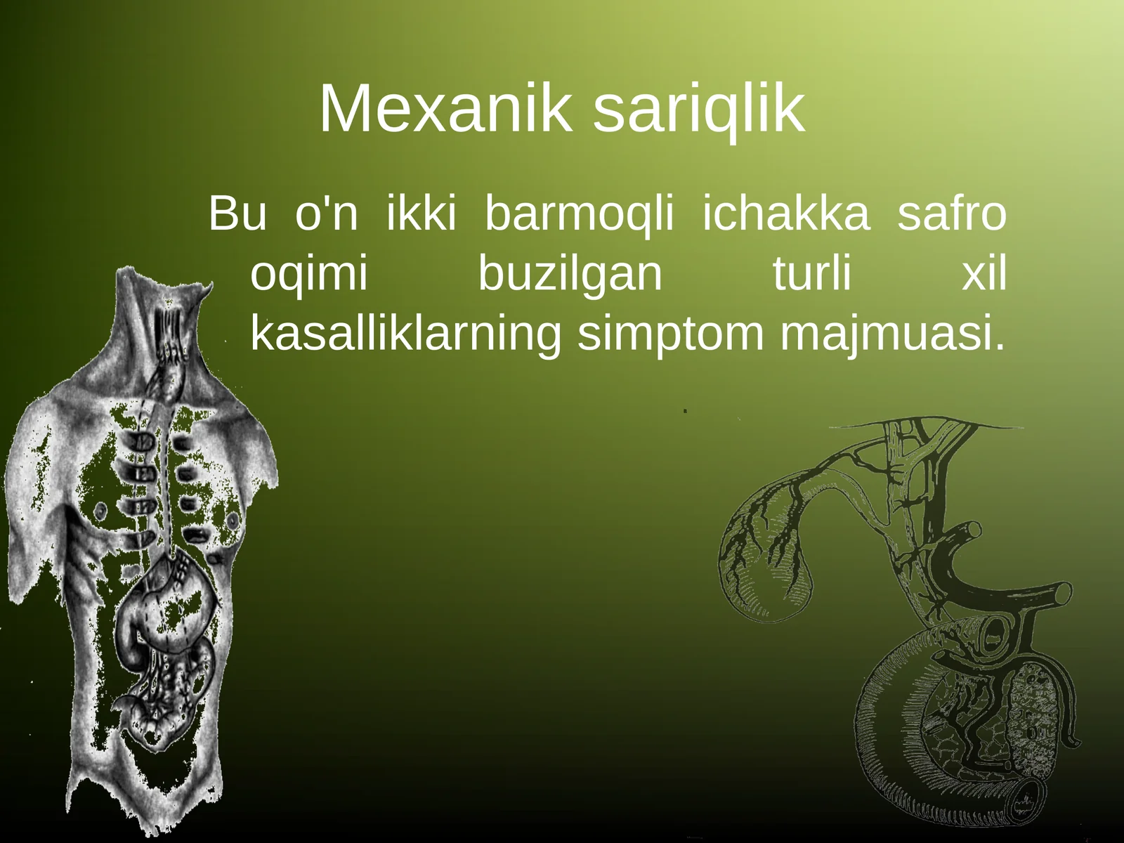 Mexanik sariqlik