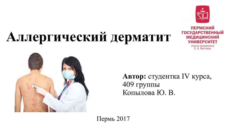 Аллергический дерматит