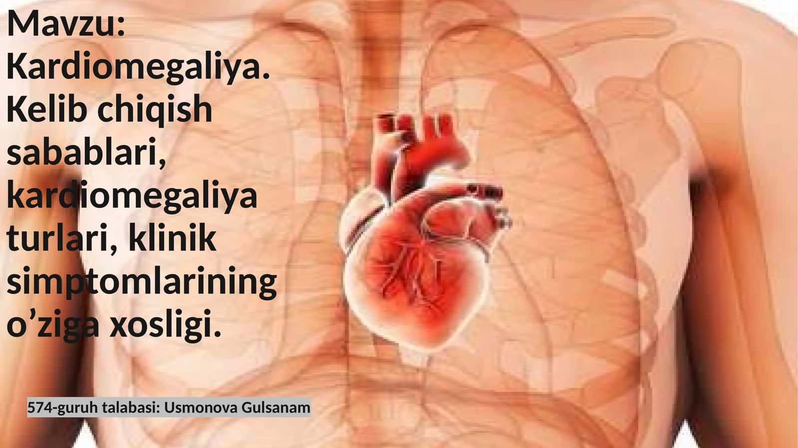 Kardiomegaliya