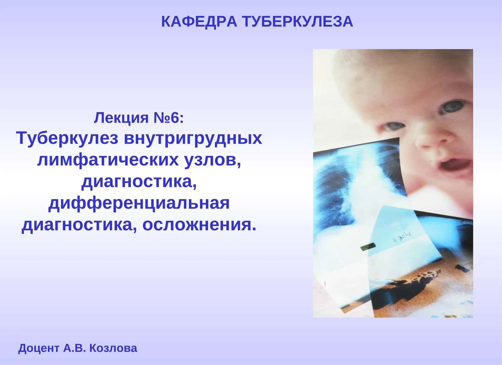 Лекция №6: Туберкулез внутригрудных лимфатических узлов