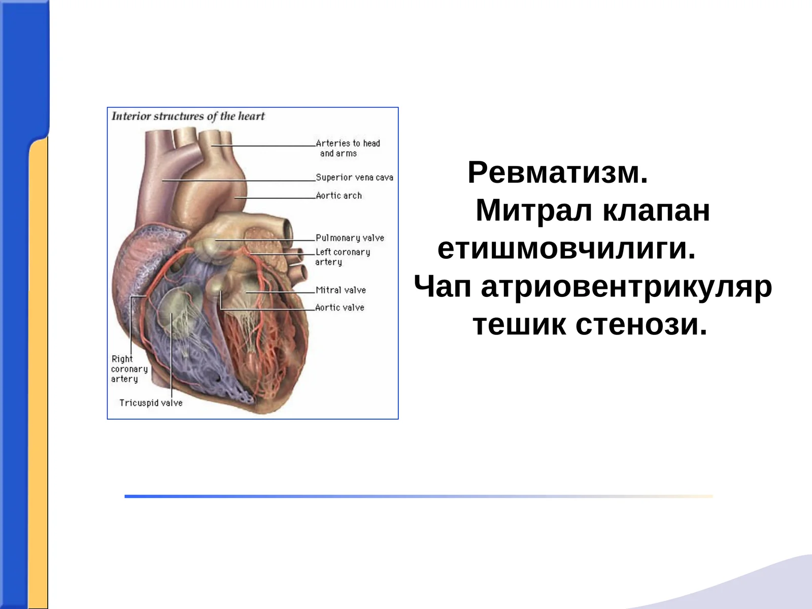Ревматизм.Митрал клапан етишмовчилиги. Чап атриовентрикуляр тешик стенози