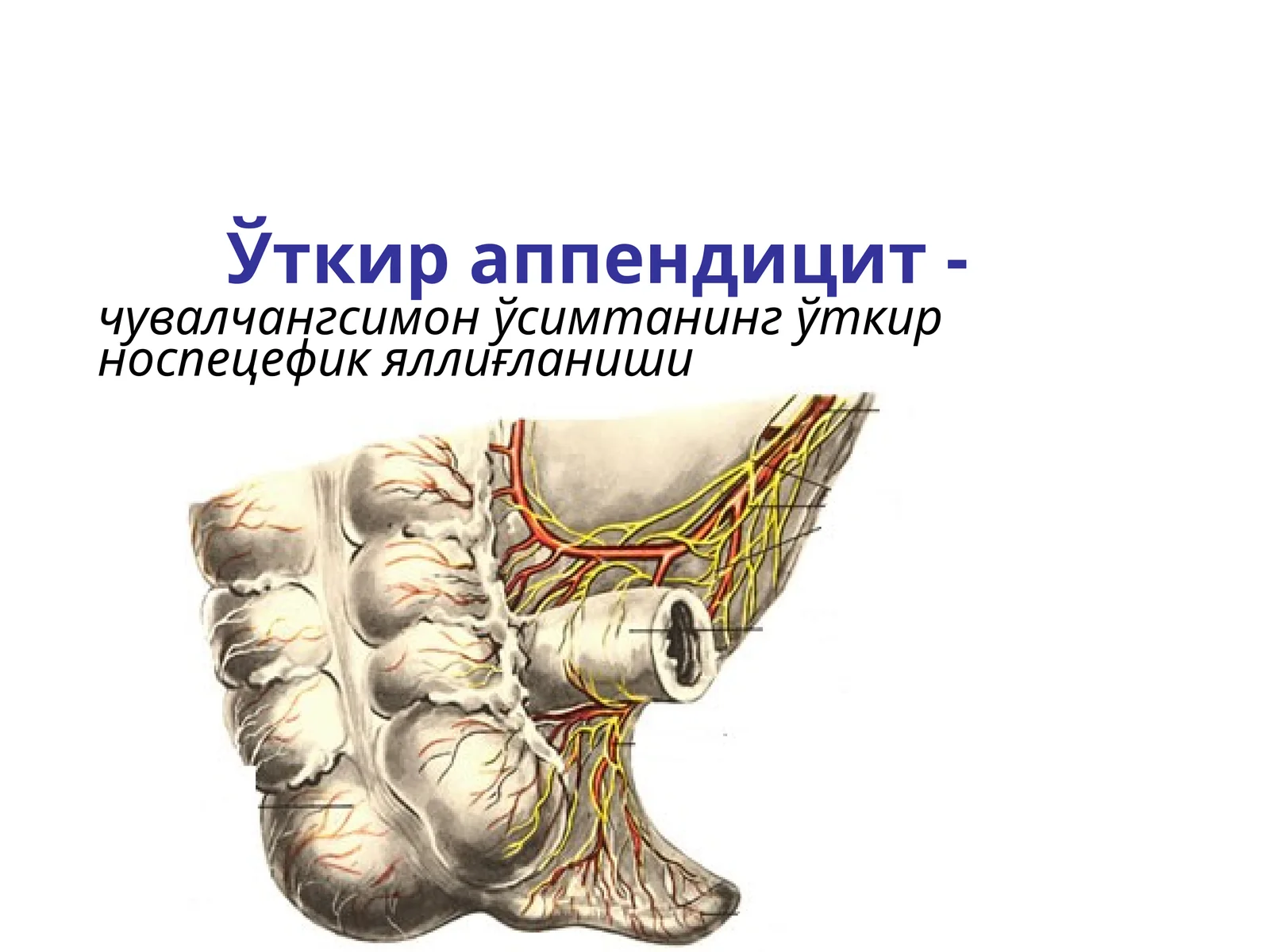 Ўткир аппендицит-чувалчангсимон ўсимтанинг ўткири носпецифик яллиғланиши