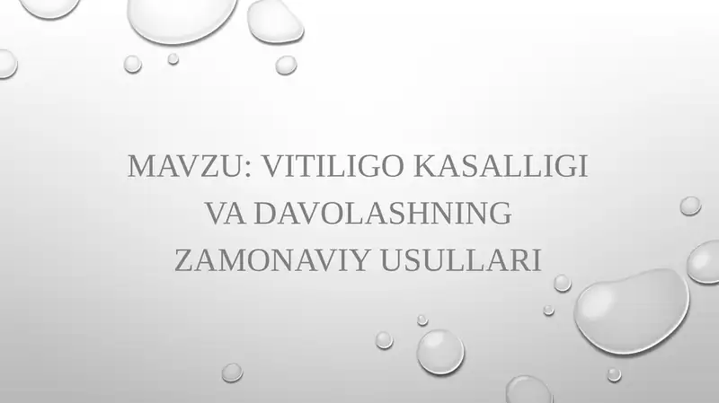 vitiligo kasalligi va davolashning Zamonaviy usullari