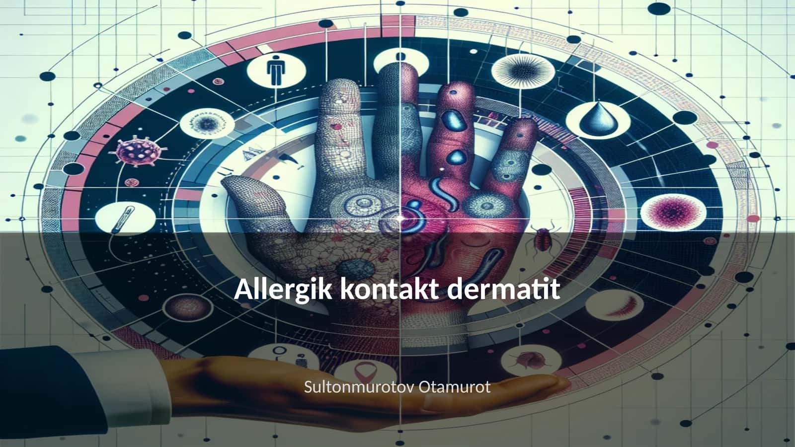 Allergik kontakt dermatit