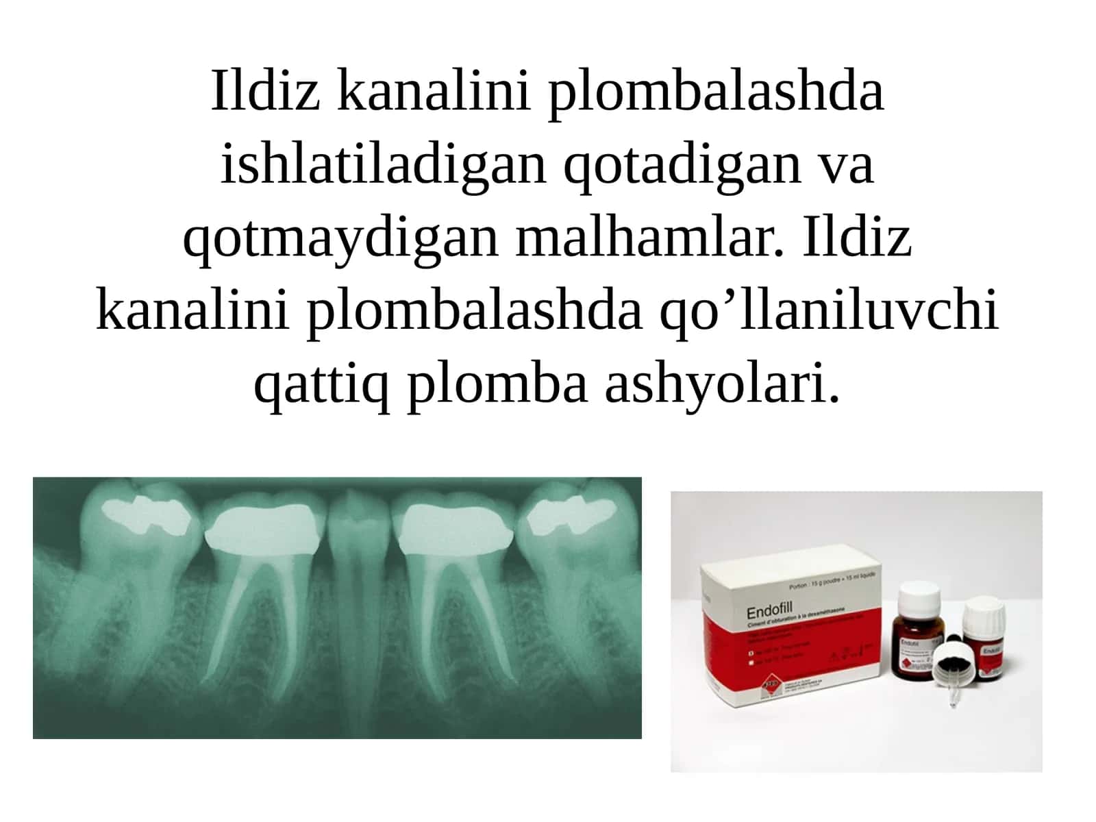 Ildiz kanalini plombalash