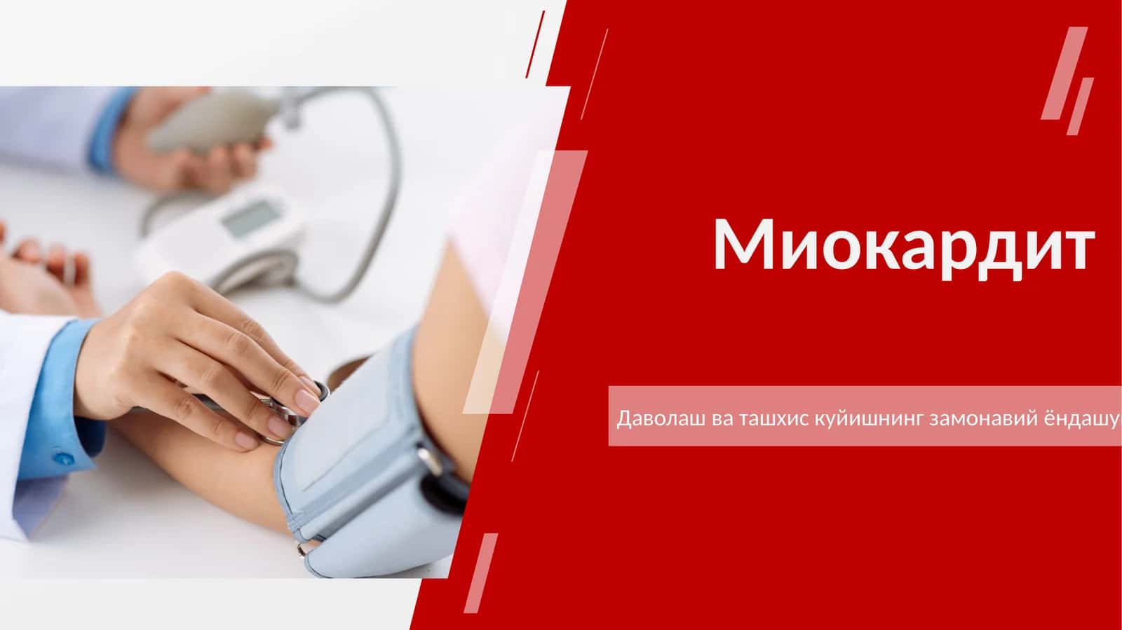 миокардит 2026