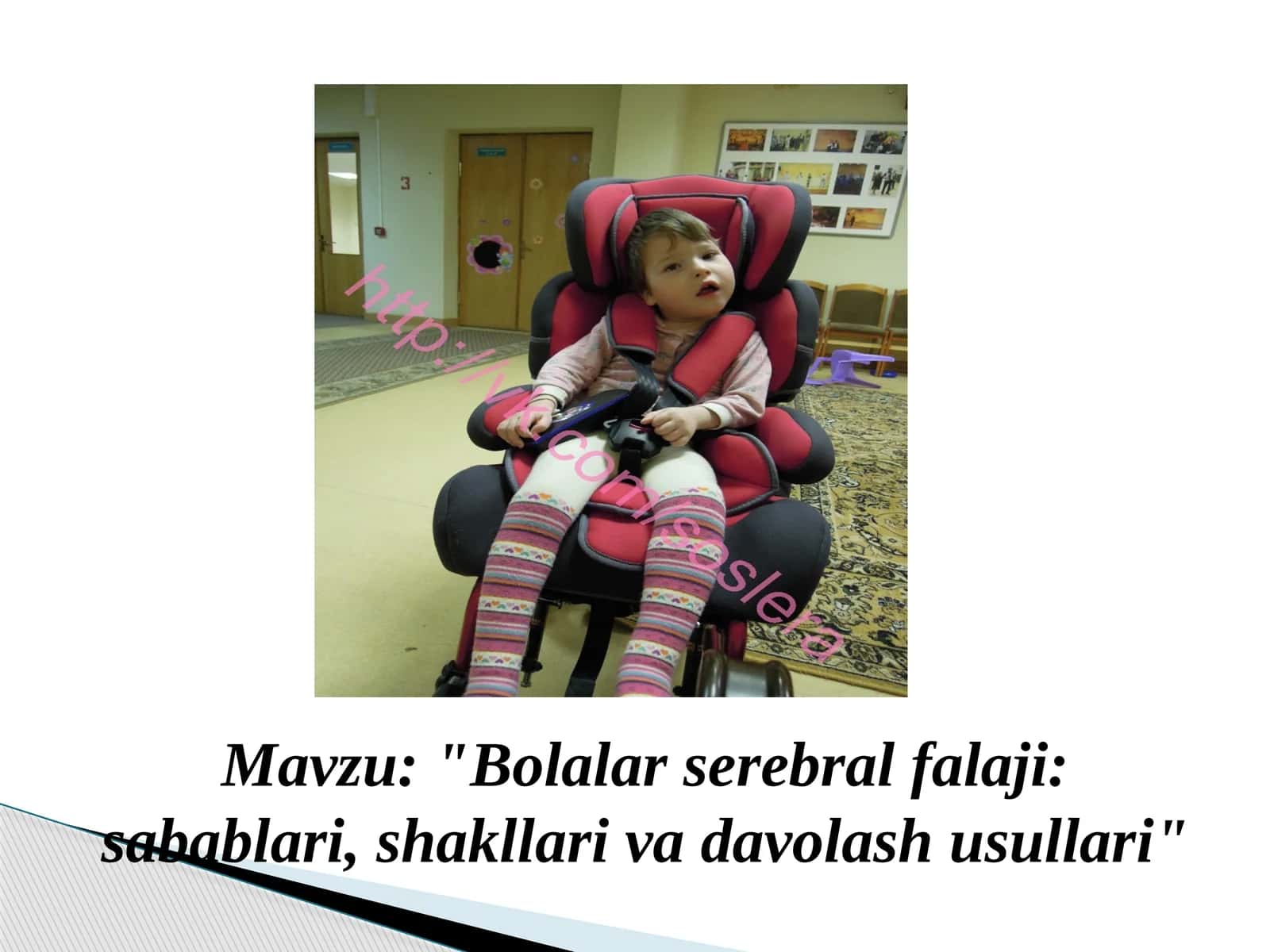 Bolalar serebral falaji (BSF) sabablari va davolash