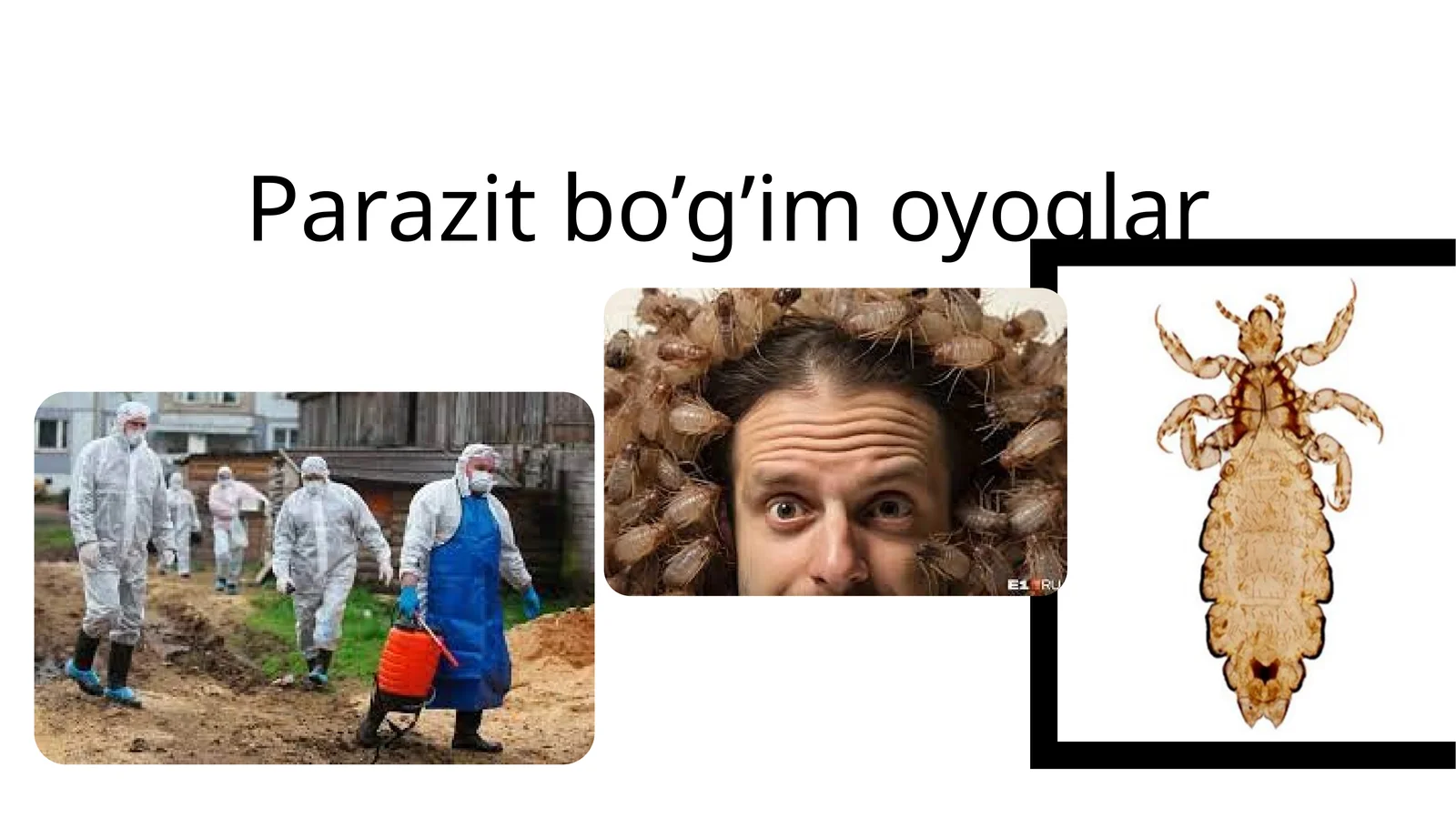 Parazitbo’g’imoyoqlar