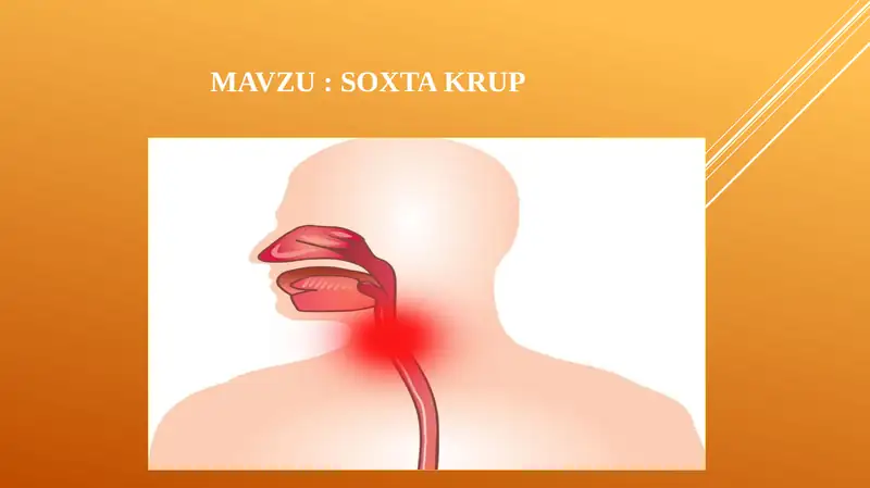 Soxta krup