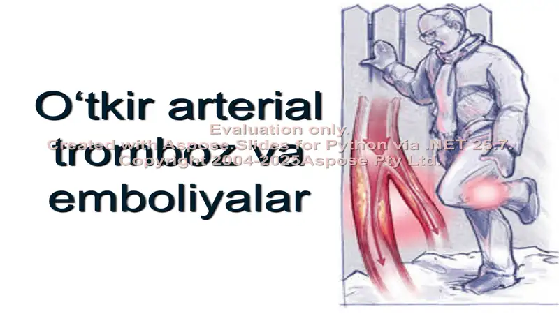 O‘tkir arterial tromboz va emboliyalar
