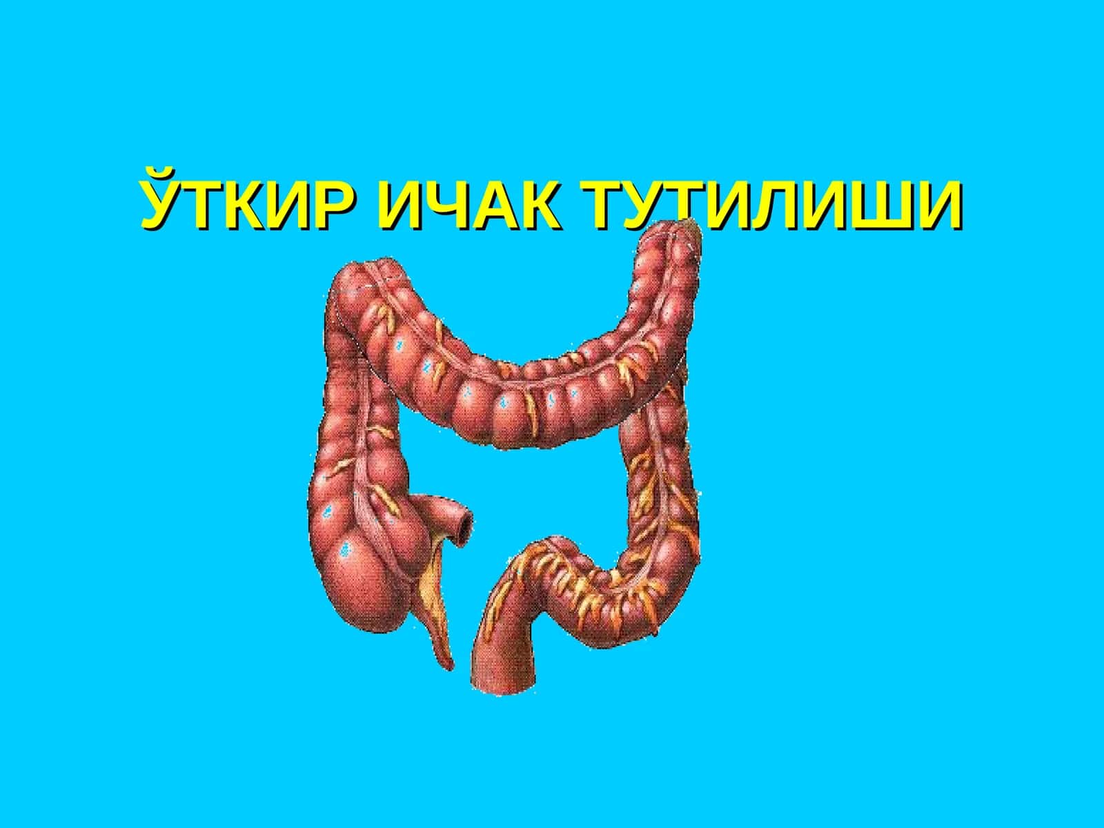 ЎТКИР ИЧАК ТУТИЛИШИ