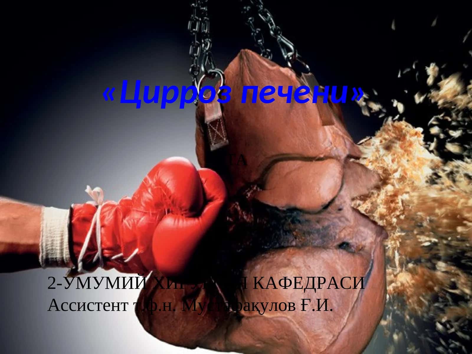 Цирроз печени