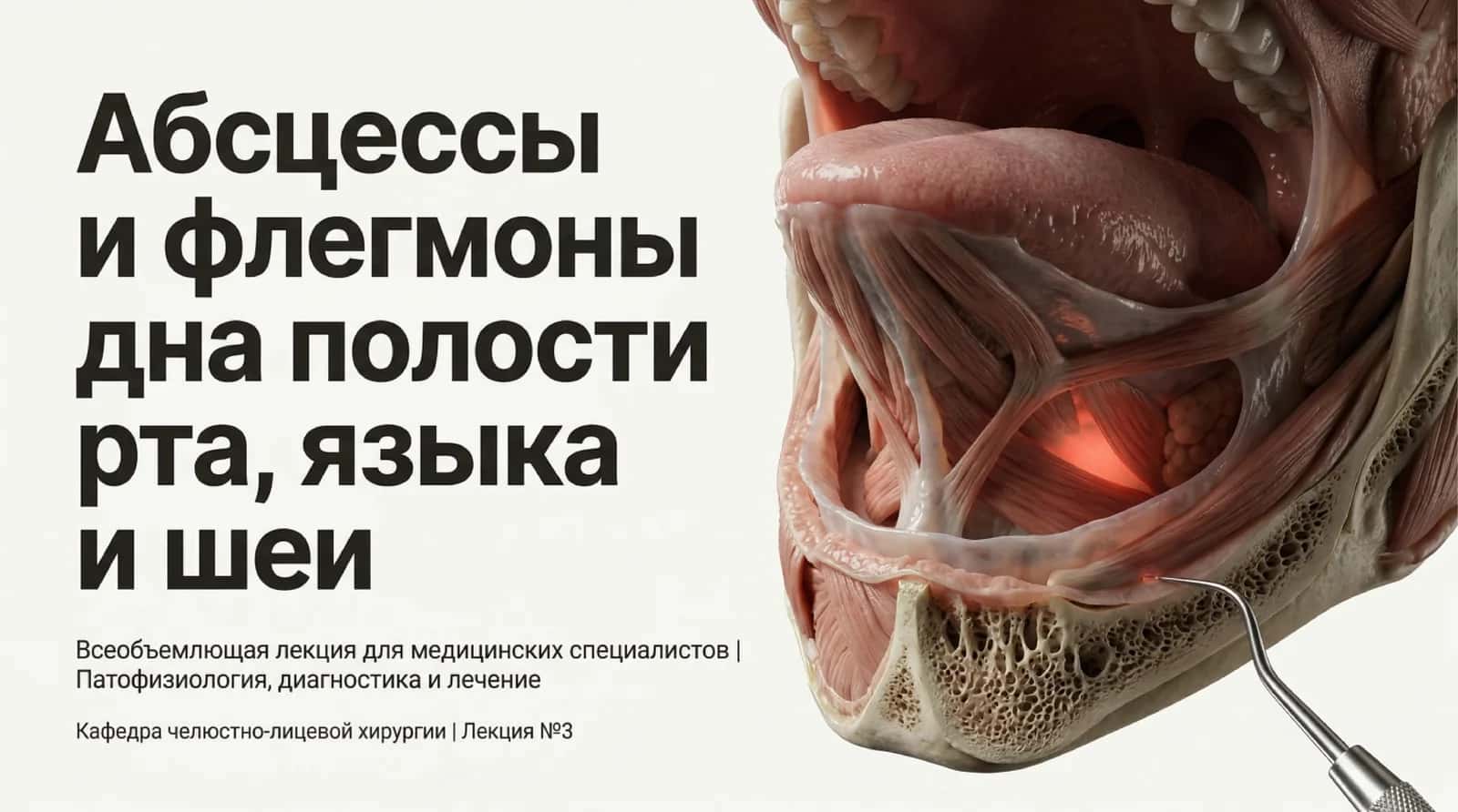 Абсцессы и флегмоны дна нолости рта языка и шеи
