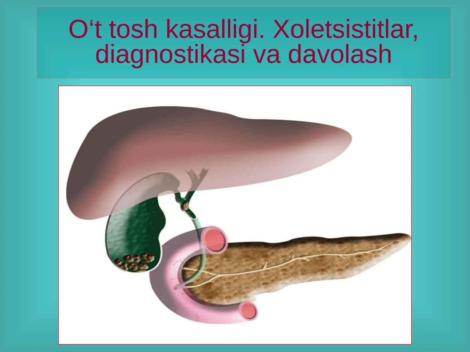 O‘t tosh kasalligi. Xoletsistitlar, diagnostikasi va davolash
