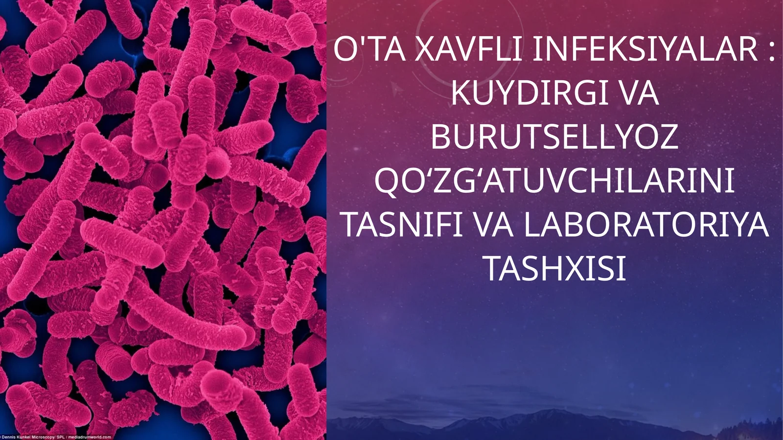 O'ta xavfli infeksiyalar  Kuydirgi va burutsellyoz qoʻzgʻatuvchilarini tasnifi va laboratoriya tashxisi